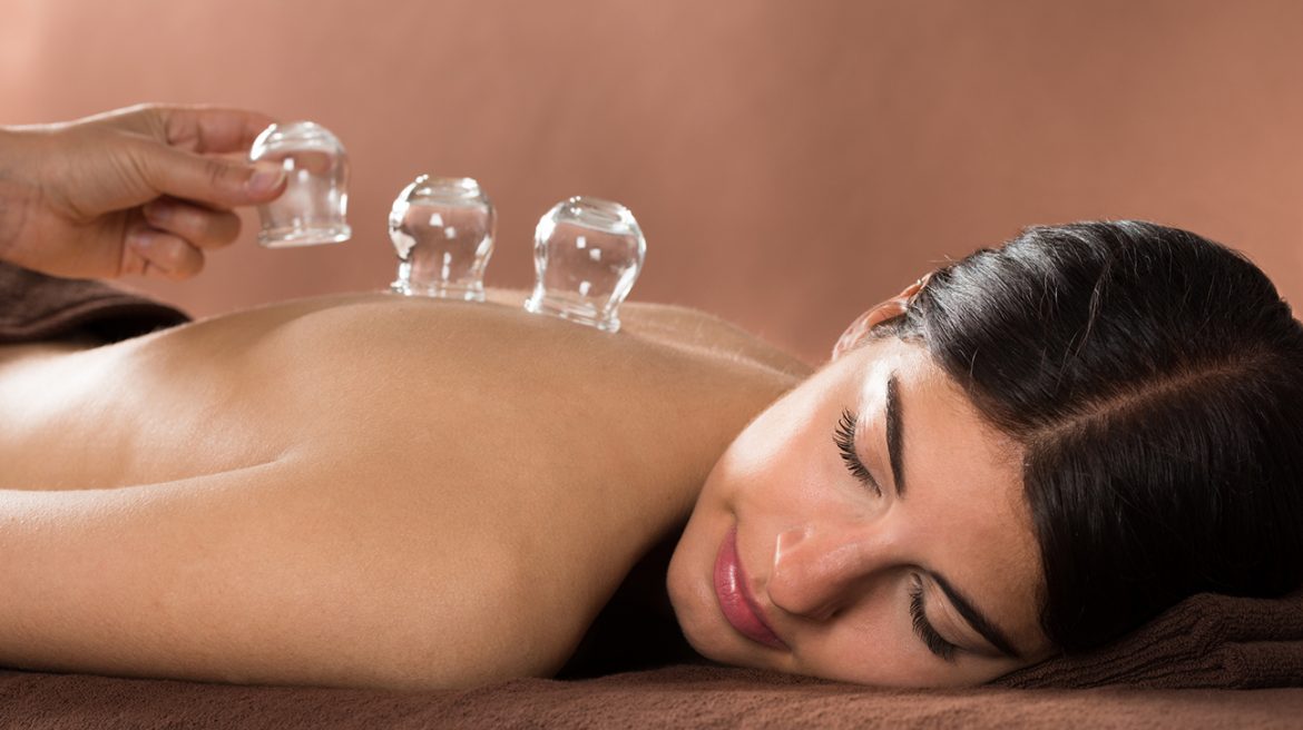 Cupping banner Cupping banner