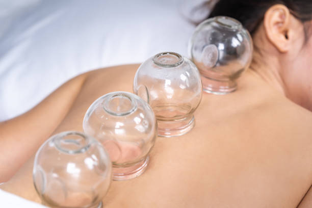 WOW 360|5 Benefits of Cupping Therapy (Hijama), How Often Should You do it