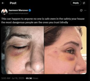Journalist Jasmeen Manzoor Accuses Ex-Husband of Assault, Shares Photos: ‘No one is safe’